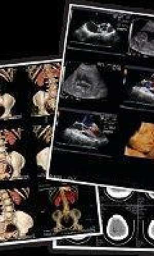 Impressões de imagens médicas Impressões de imagens médicas